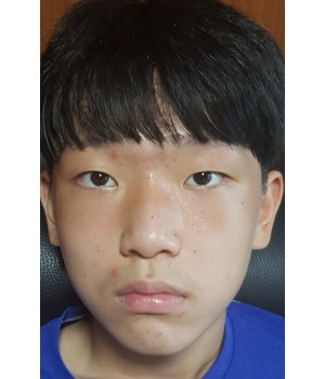 김규동